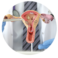 Option 1 Urogyne-2